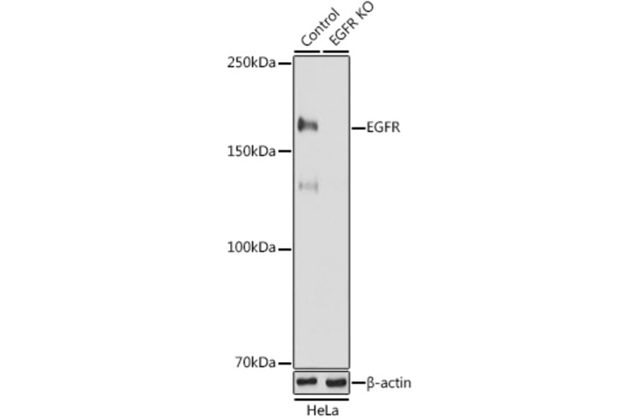 Western Blot - Anti-EGFR Antibody (A81016) - Antibodies.com