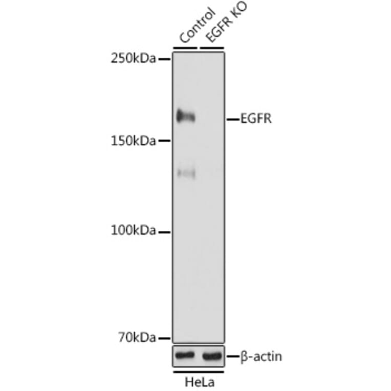 Western Blot - Anti-EGFR Antibody (A81016) - Antibodies.com
