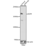 Western Blot - Anti-EGFR Antibody (A81016) - Antibodies.com