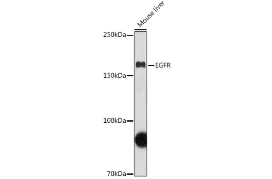 Western Blot - Anti-EGFR Antibody (A81016) - Antibodies.com