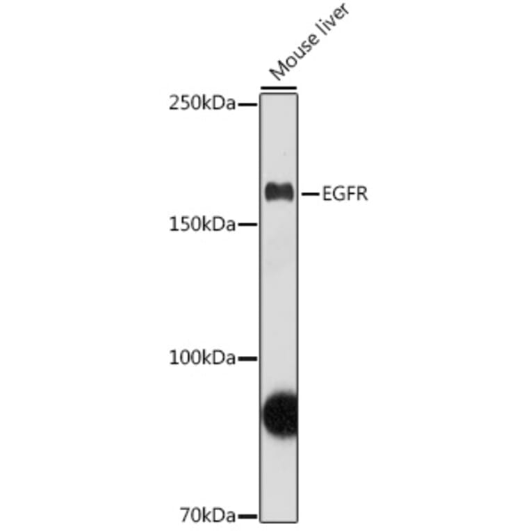 Western Blot - Anti-EGFR Antibody (A81016) - Antibodies.com