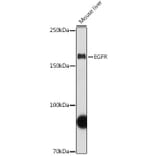 Western Blot - Anti-EGFR Antibody (A81016) - Antibodies.com