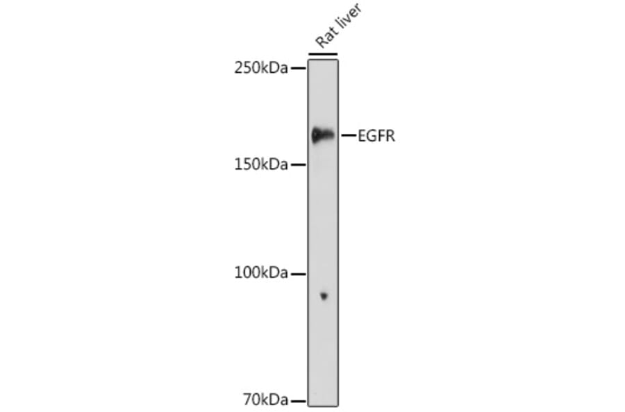 Western Blot - Anti-EGFR Antibody (A81016) - Antibodies.com