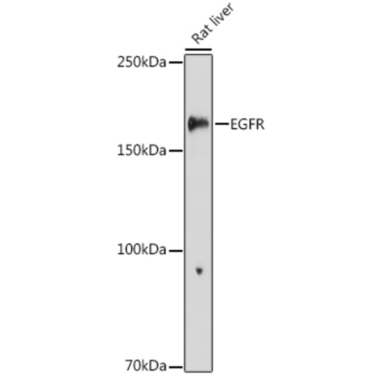 Western Blot - Anti-EGFR Antibody (A81016) - Antibodies.com