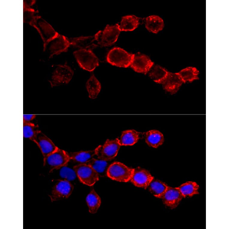 Immunofluorescence - Anti-EGFR Antibody (A81016) - Antibodies.com