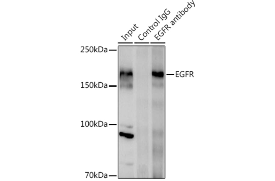 Western Blot - Anti-EGFR Antibody (A81016) - Antibodies.com