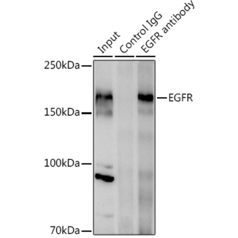 Western Blot - Anti-EGFR Antibody (A81016) - Antibodies.com