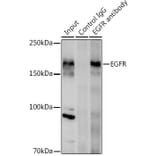 Western Blot - Anti-EGFR Antibody (A81016) - Antibodies.com