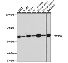Western Blot - Anti-MMP11 Antibody [ARC0523] (A81017) - Antibodies.com