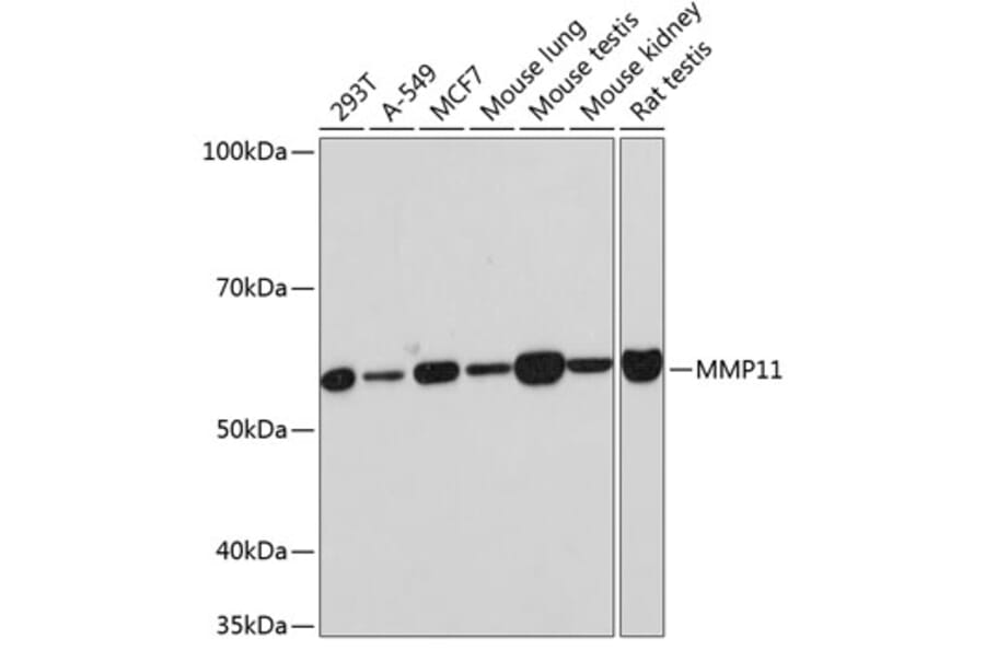 Western Blot - Anti-MMP11 Antibody [ARC0523] (A81017) - Antibodies.com