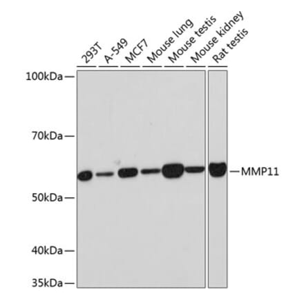 Western Blot - Anti-MMP11 Antibody [ARC0523] (A81017) - Antibodies.com