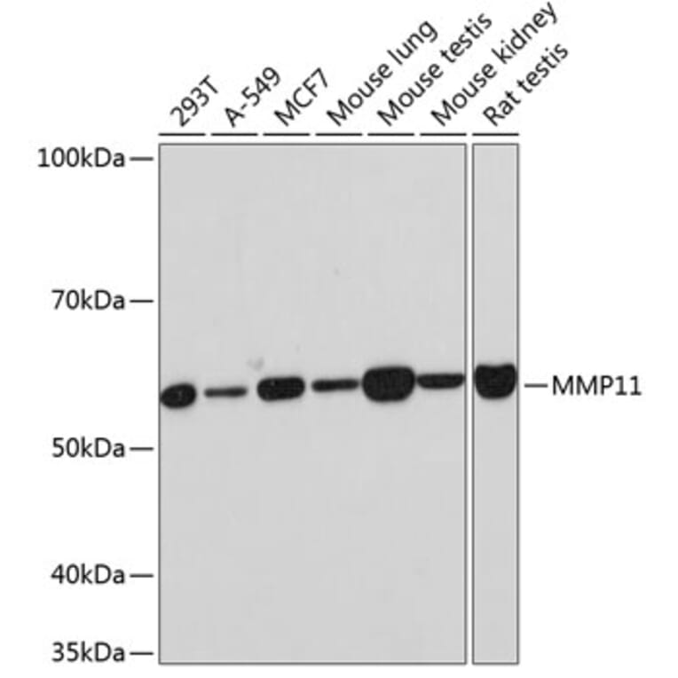 Western Blot - Anti-MMP11 Antibody [ARC0523] (A81017) - Antibodies.com