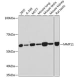 Western Blot - Anti-MMP11 Antibody [ARC0523] (A81017) - Antibodies.com