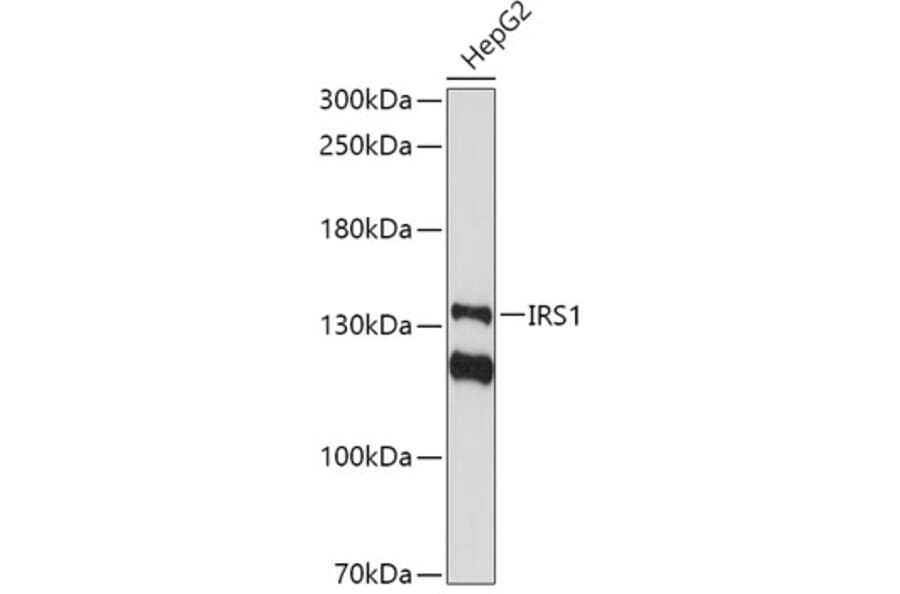 Western Blot - Anti-IRS1 Antibody (A11121) - Antibodies.com
