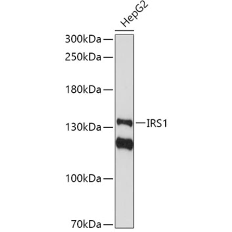 Western Blot - Anti-IRS1 Antibody (A11121) - Antibodies.com