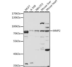 Western Blot - Anti-MMP2 Antibody (A81020) - Antibodies.com
