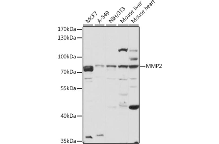 Western Blot - Anti-MMP2 Antibody (A81020) - Antibodies.com