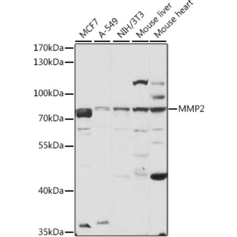 Western Blot - Anti-MMP2 Antibody (A81020) - Antibodies.com