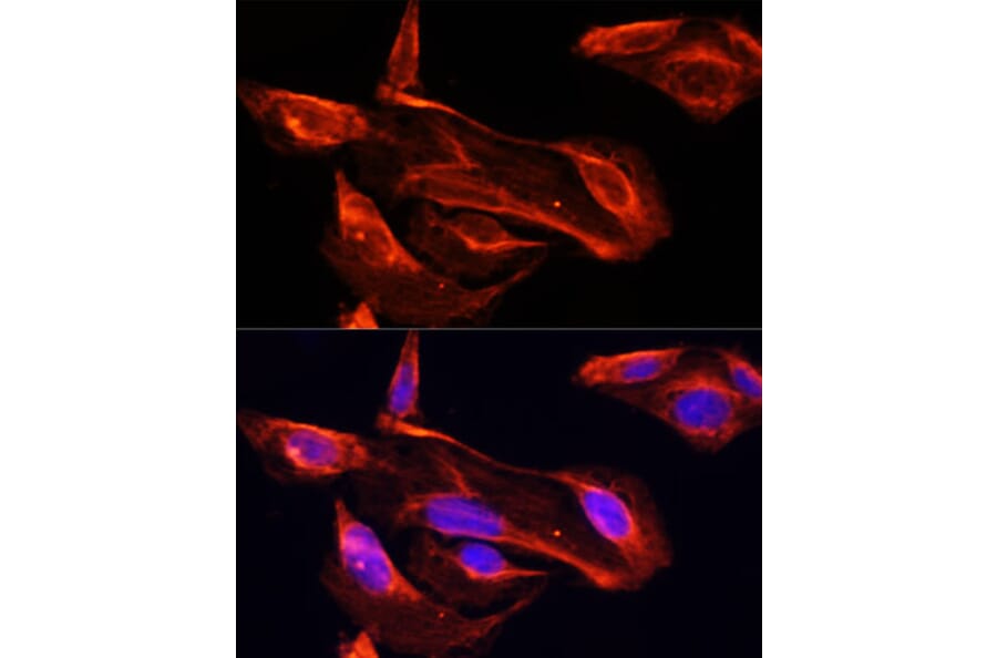 Immunofluorescence - Anti-MMP2 Antibody (A81020) - Antibodies.com