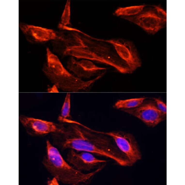 Immunofluorescence - Anti-MMP2 Antibody (A81020) - Antibodies.com