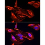 Immunofluorescence - Anti-MMP2 Antibody (A81020) - Antibodies.com