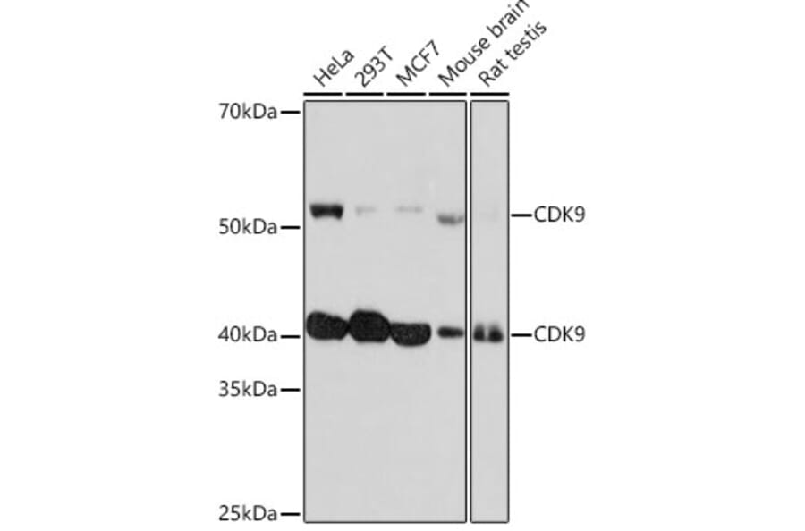 Western Blot - Anti-Cdk9 Antibody [ARC0527] (A81021) - Antibodies.com