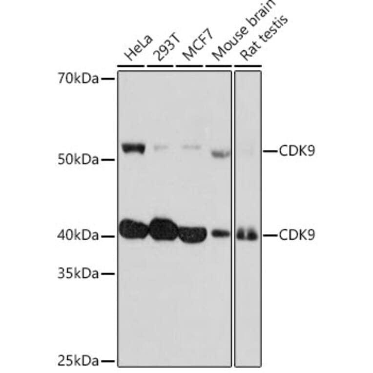 Western Blot - Anti-Cdk9 Antibody [ARC0527] (A81021) - Antibodies.com