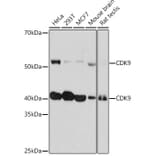 Western Blot - Anti-Cdk9 Antibody [ARC0527] (A81021) - Antibodies.com