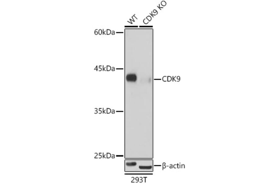 Western Blot - Anti-Cdk9 Antibody [ARC0527] (A81021) - Antibodies.com