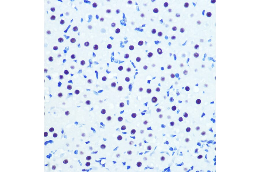 Immunohistochemistry - Anti-Cdk9 Antibody [ARC0527] (A81021) - Antibodies.com