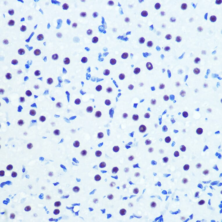 Immunohistochemistry - Anti-Cdk9 Antibody [ARC0527] (A81021) - Antibodies.com