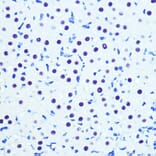 Immunohistochemistry - Anti-Cdk9 Antibody [ARC0527] (A81021) - Antibodies.com