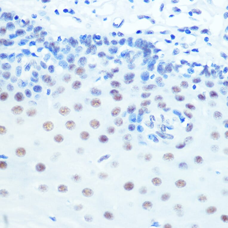 Immunohistochemistry - Anti-Cdk9 Antibody [ARC0527] (A81021) - Antibodies.com