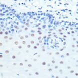 Immunohistochemistry - Anti-Cdk9 Antibody [ARC0527] (A81021) - Antibodies.com