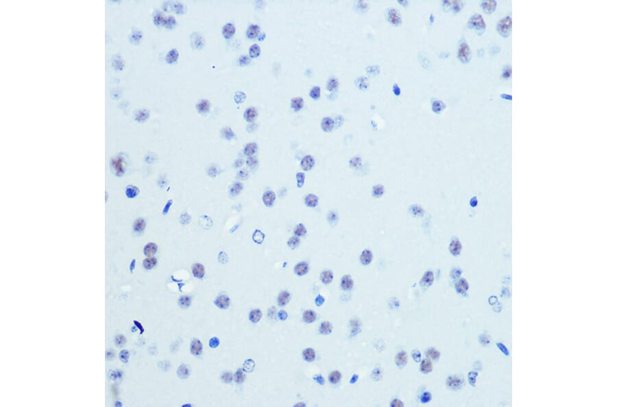 Immunohistochemistry - Anti-Cdk9 Antibody [ARC0527] (A81021) - Antibodies.com