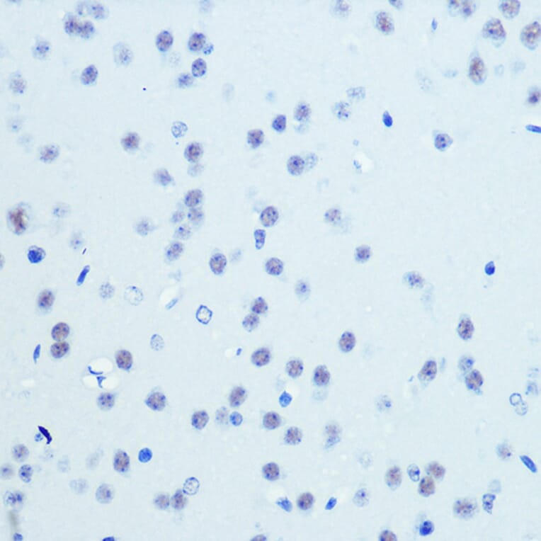 Immunohistochemistry - Anti-Cdk9 Antibody [ARC0527] (A81021) - Antibodies.com