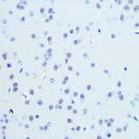 Immunohistochemistry - Anti-Cdk9 Antibody [ARC0527] (A81021) - Antibodies.com