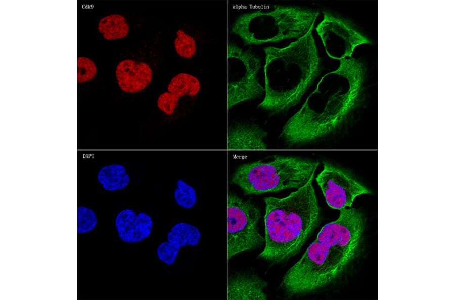 Immunofluorescence - Anti-Cdk9 Antibody [ARC0527] (A81021) - Antibodies.com