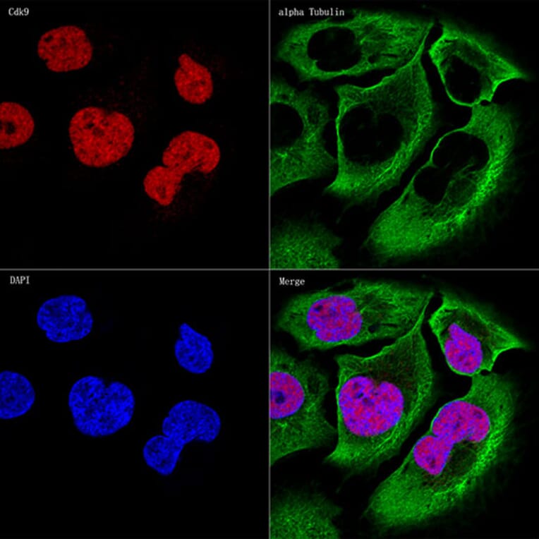 Immunofluorescence - Anti-Cdk9 Antibody [ARC0527] (A81021) - Antibodies.com