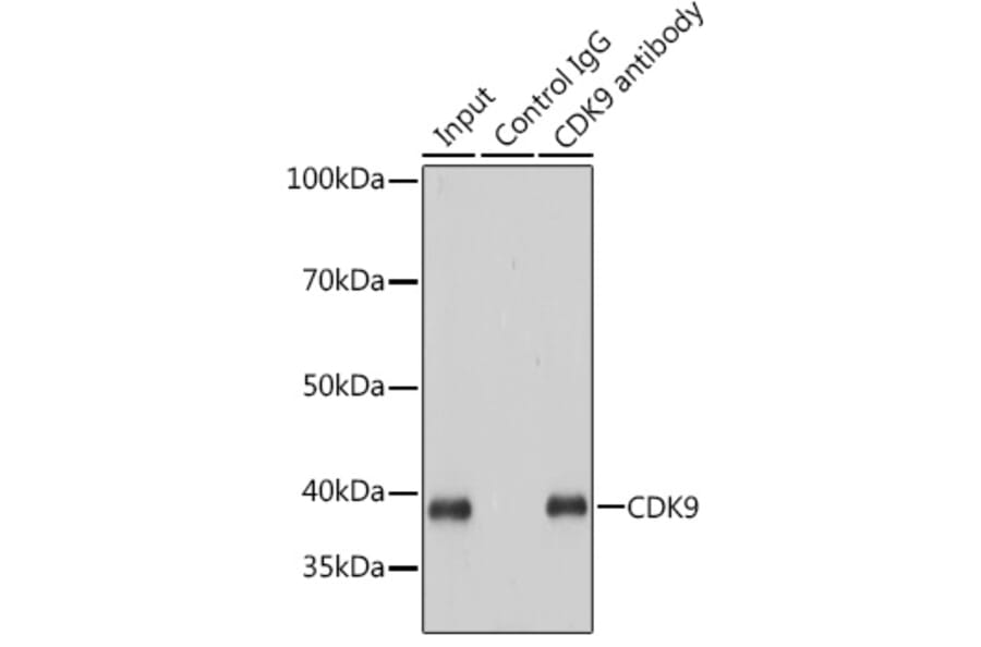 Western Blot - Anti-Cdk9 Antibody [ARC0527] (A81021) - Antibodies.com