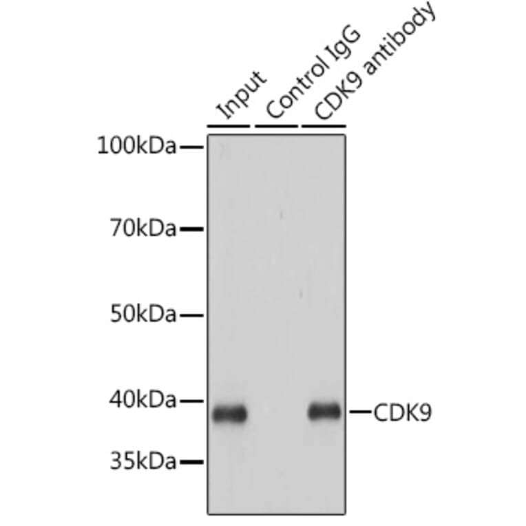 Western Blot - Anti-Cdk9 Antibody [ARC0527] (A81021) - Antibodies.com