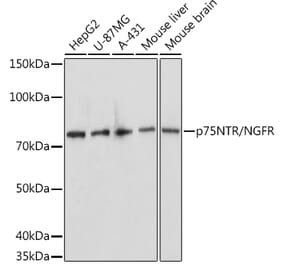 Western Blot - Anti-p75 NGF Receptor Antibody (A81022) - Antibodies.com