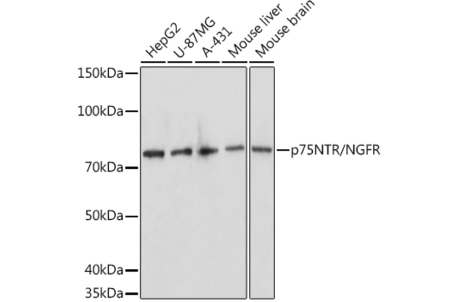 Western Blot - Anti-p75 NGF Receptor Antibody (A81022) - Antibodies.com