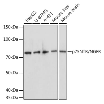Western Blot - Anti-p75 NGF Receptor Antibody (A81022) - Antibodies.com
