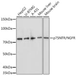 Western Blot - Anti-p75 NGF Receptor Antibody (A81022) - Antibodies.com