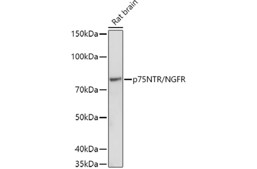 Western Blot - Anti-p75 NGF Receptor Antibody (A81022) - Antibodies.com