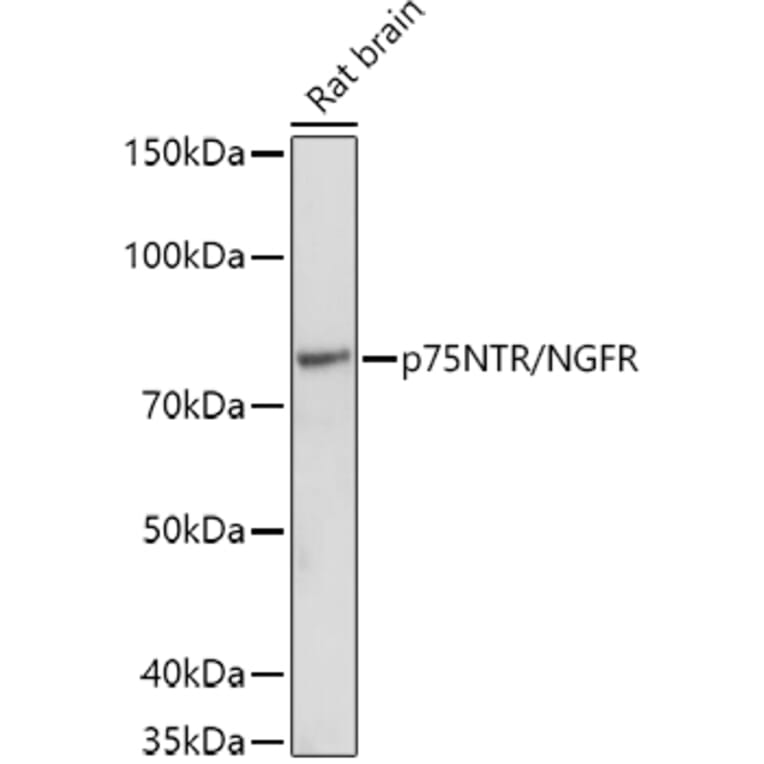 Western Blot - Anti-p75 NGF Receptor Antibody (A81022) - Antibodies.com