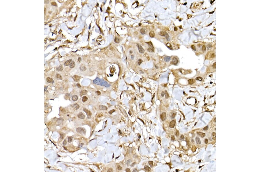 Immunohistochemistry - Anti-PTEN Antibody (A81023) - Antibodies.com