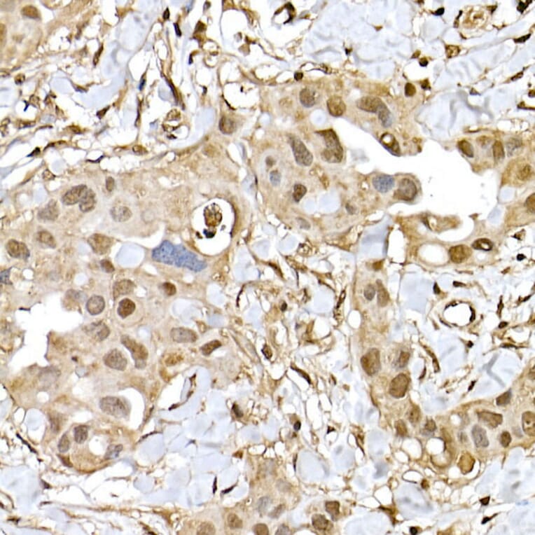 Immunohistochemistry - Anti-PTEN Antibody (A81023) - Antibodies.com