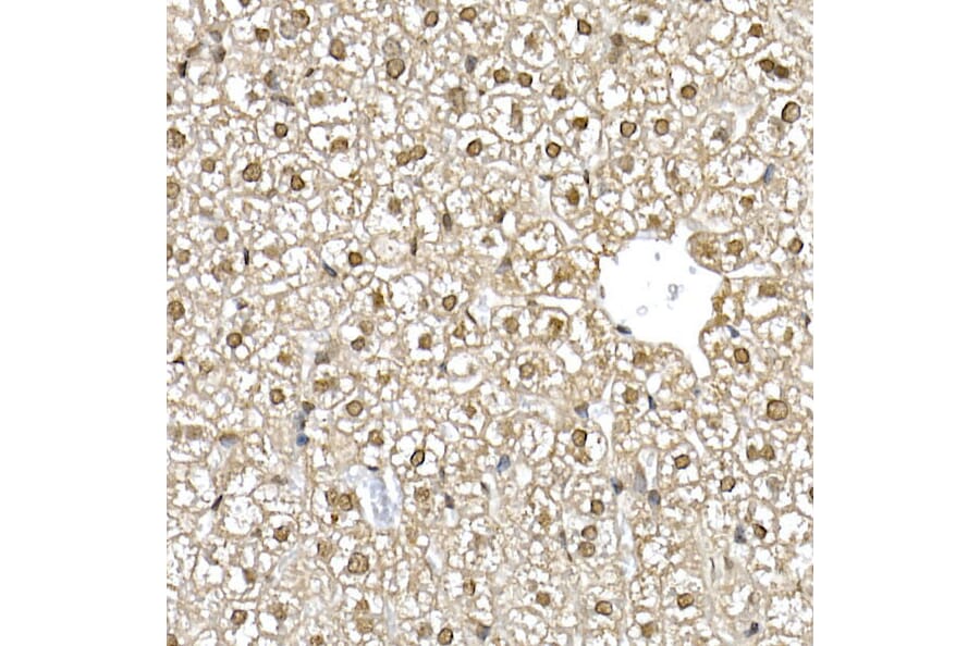 Immunohistochemistry - Anti-PTEN Antibody (A81023) - Antibodies.com